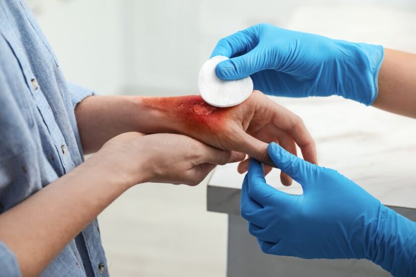 Doctor Cleaning Up A Wound On A Patients Hand